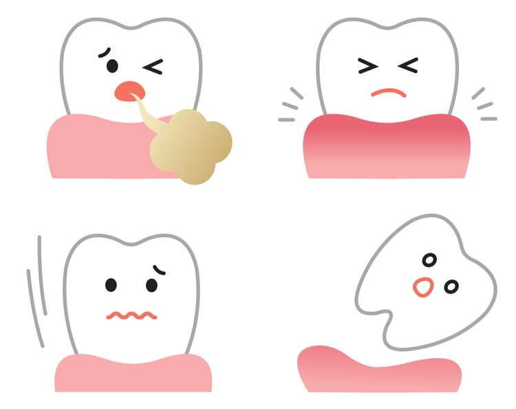 歯周病　前兆